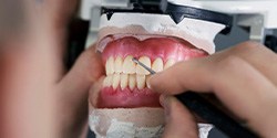 a technician working on developing a set of dentures