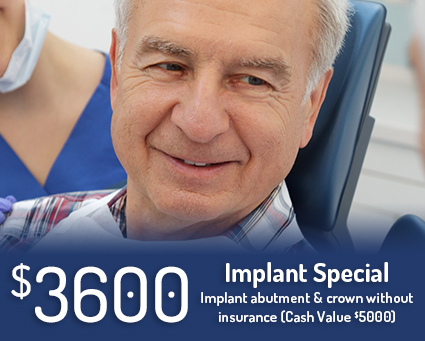 3600 dollar dental implant special implant abutment and crown without insurance cash value 5000 dollars